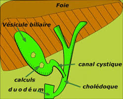 Ablation de la vésicule biliaire ⎪Chirurgie viscérale et digestive